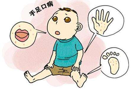 春意盎然，勿忘防治手足口